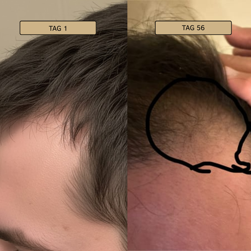 BALDUR - ODIN: Follikel Aktivator Serum mit DMR-Komplex™