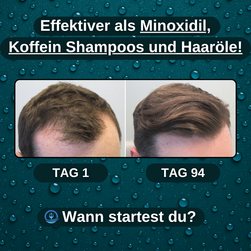 Baldur - TRITON: KUPFERTRIPEPTID SHAMPOO MIT PFLANZENKRAFT!